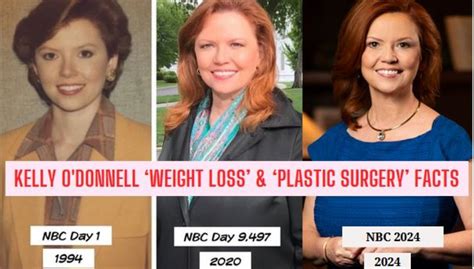 Kelly O Donnell Alleged Plastic Surgery Weight Loss Facts