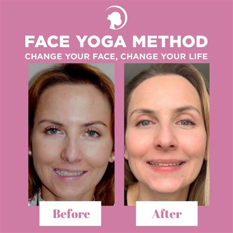 Unveil Ultimate Face Yoga Results: Before & After