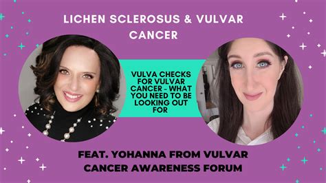 Vulva Checks For Vulvar Cancer What To Look Out For Lssn