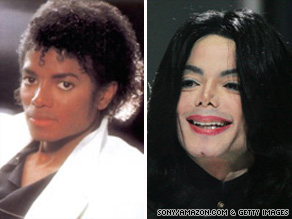 Why Michael Jackson Kids White